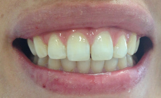 2. ODONTOLOGIA RESTAURADORA ESTETICA