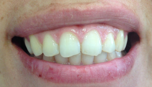 2. ODONTOLOGIA RESTAURADORA ESTETICA
