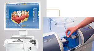 1. REHABILITACION ORAL Y ESTETICA EN CEREC